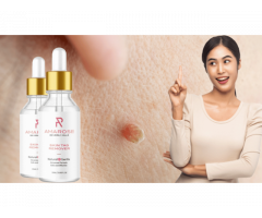Amarose Skin Tag Remover Review (USA): Does It Work? Urgent Customer Update!